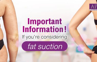 Shape Your Body Contours with Fat Suction: Achieve Your Ideal Figure at Apex Cosmetic Surgery Cente
