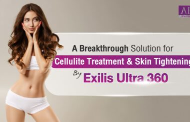 Understanding Cellulite and How Exilis Can Help Cellulite is a prevalent condition that affects individuals globally, manifesting as a bumpy and dimpled skin texture