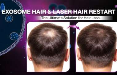 Laser Hair Restart - The Ultimate Solution for Hair Loss