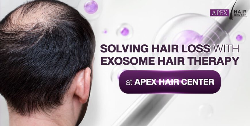 Rediscover Lustrous Hair and Overcome Hair Loss with Exosome Hair Therapy at APEX Hair Center