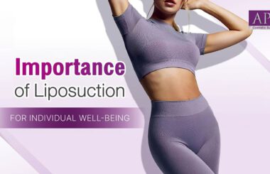 Liposuction is a carefully performed surgical technique intended to eliminate specific areas of excess fat and improve the overall shape and contour of the body.