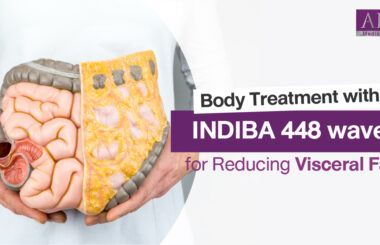Body Treatment with INDIBA 448 wave for Reducing Visceral Fat: Exploring the Benefits of Advanced Technology