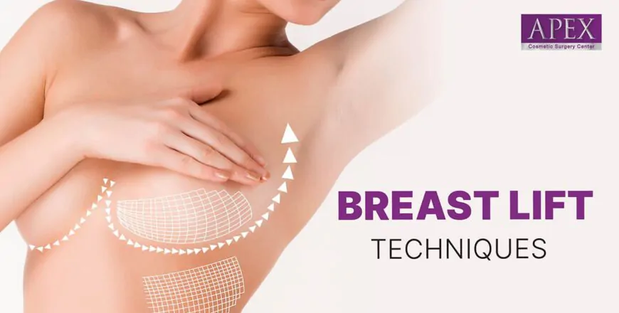 Timing Your Breast Lift: When Should You Consider this Procedure?