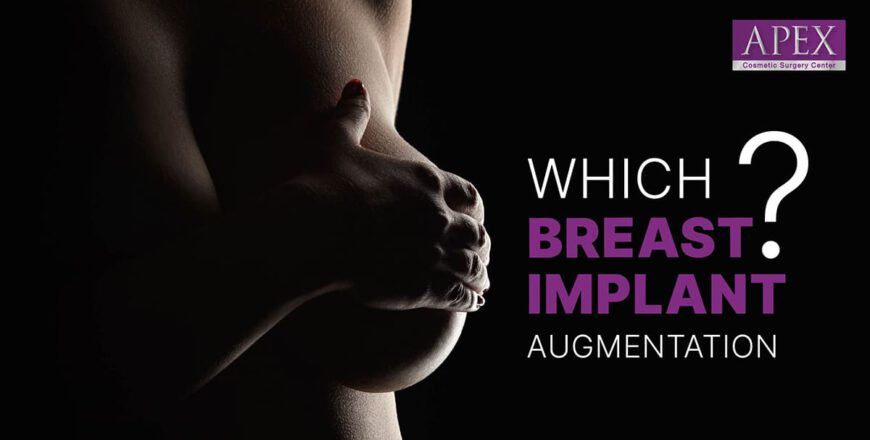 Optimal Breast Augmentation: Deciding on the Perfect Shape for Breast  Implants - Apex Medical Center