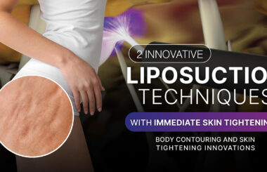 2 Innovative Liposuction Techniques with Immediate Skin Tightening!! Body Contouring and Skin Tightening Innovations