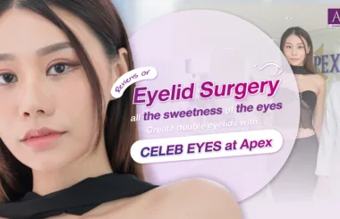 Reviews of double eyelid surgery all the sweetness of the eyes Create double eyelids with Celeb Eyes at Apex