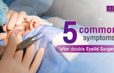 5 common symptoms after double eyelid surgery