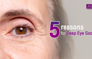 5 reasons for deep eye sockets