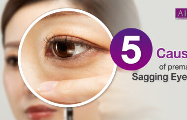 5 causes of premature sagging eyelids