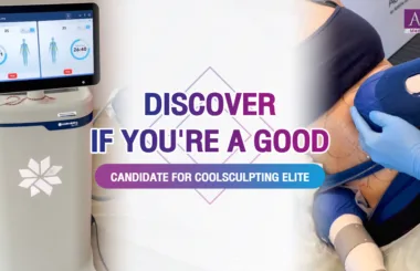 Discover if You’re a Good Candidate for CoolSculpting Elite