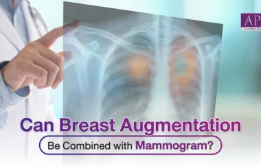 Can Breast Augmentation Be Combined with Mammogram?