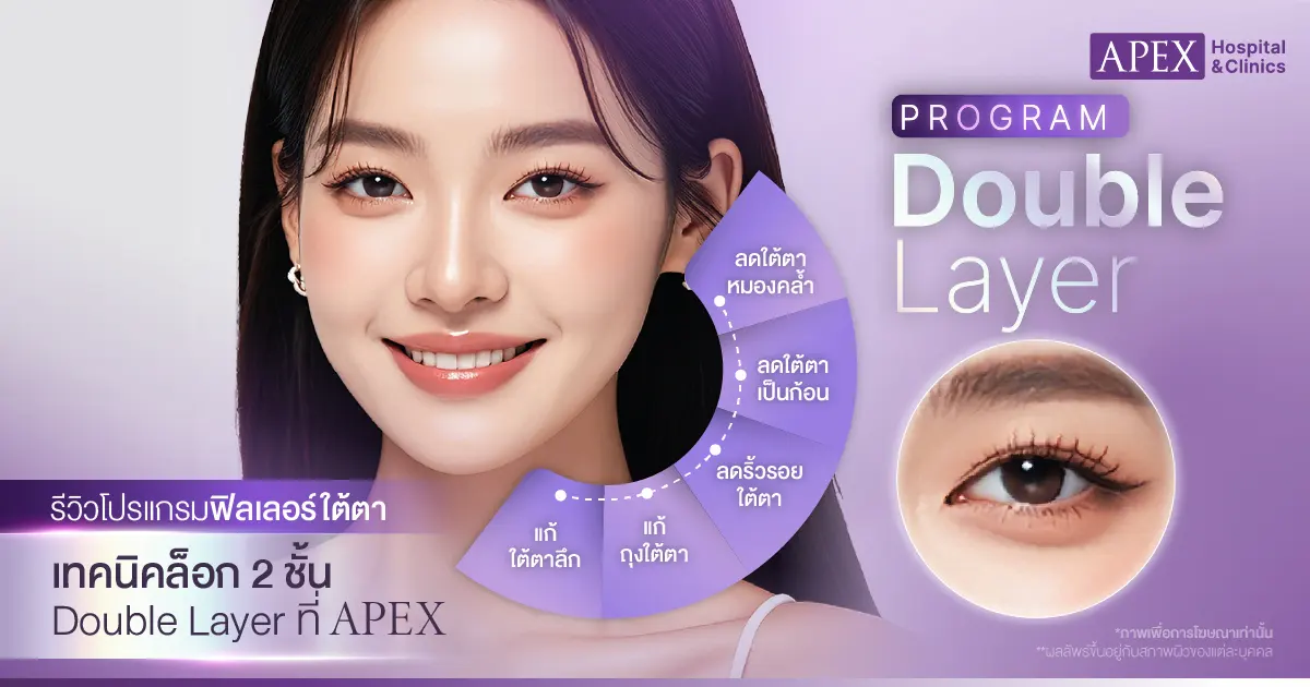 รีวิวฟิลเลอร์ใต้ตา