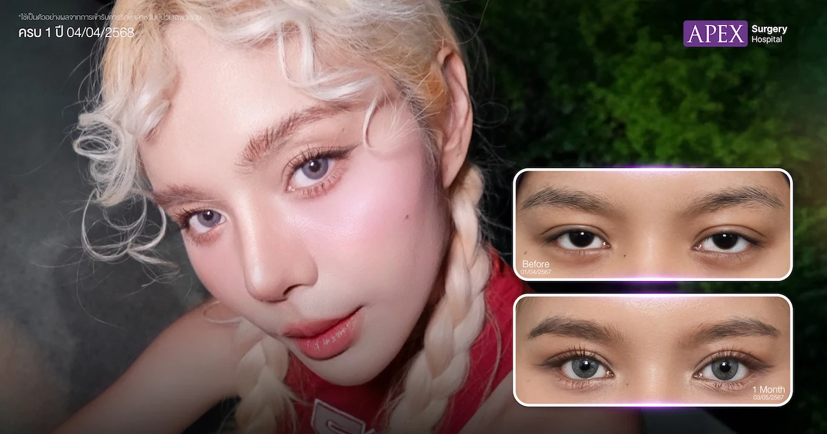 รีวิวทำตาสองชั้น