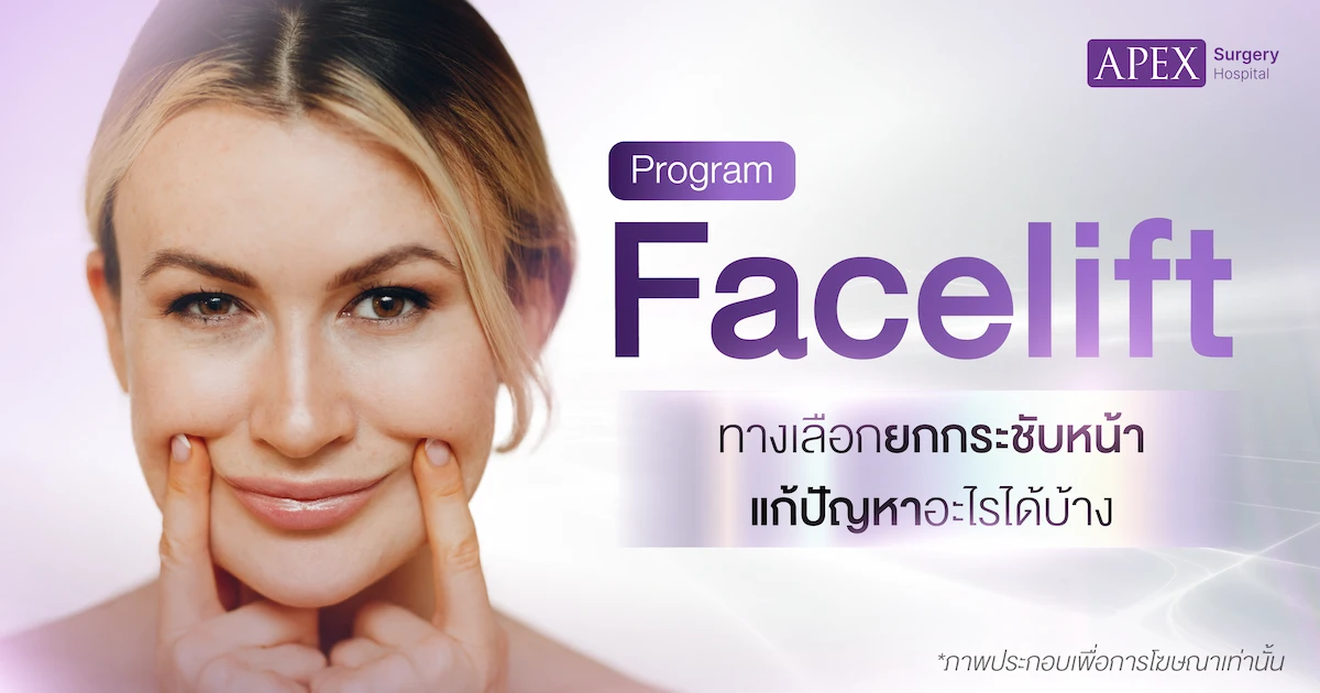 Facelift