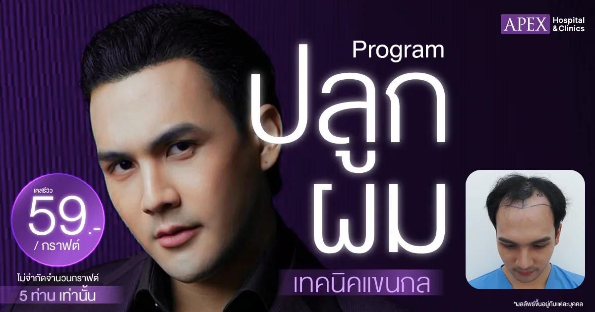 ปลูกผม ราคา