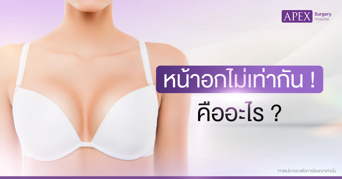 หน้าอกไม่เท่ากัน คืออะไร