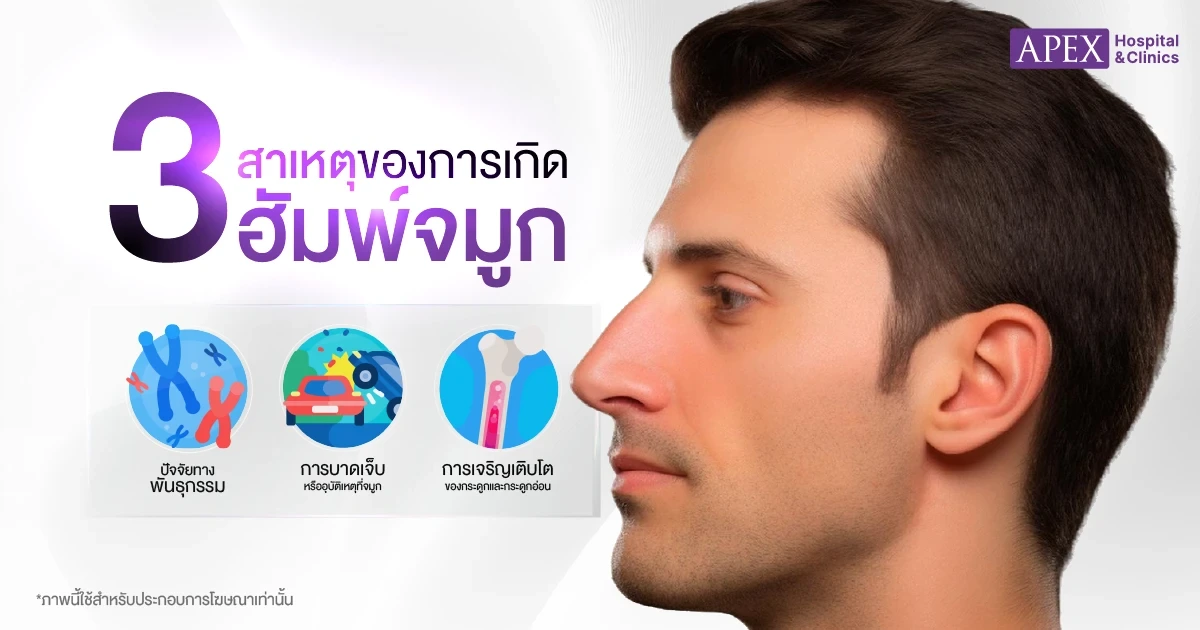 สาเหตุของการเกิดฮัมพ์จมูก