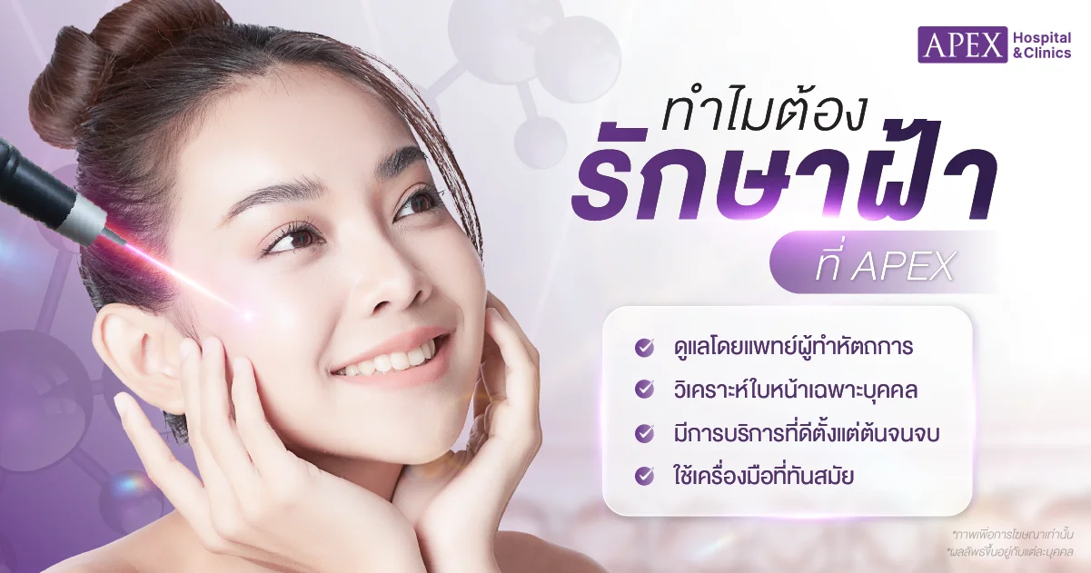 Pico laser รักษาฝ้า