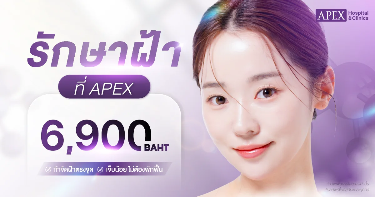 รักษาฝ้า ราคา