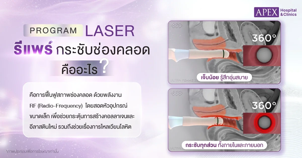 รีแพร์ กระชับช่องคลอด คืออะไร