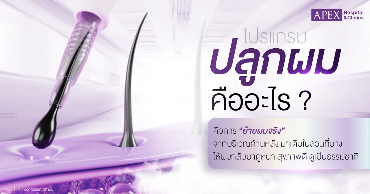 ปลูกผม คืออะไร