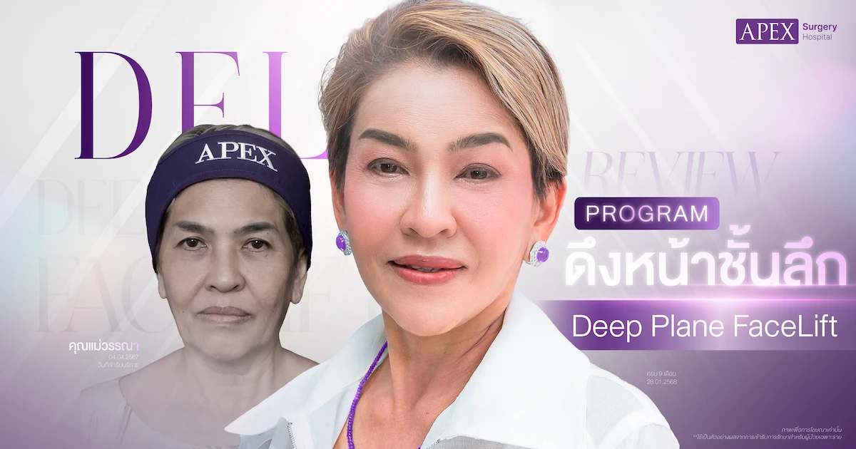 รีวิวดึงหน้า
