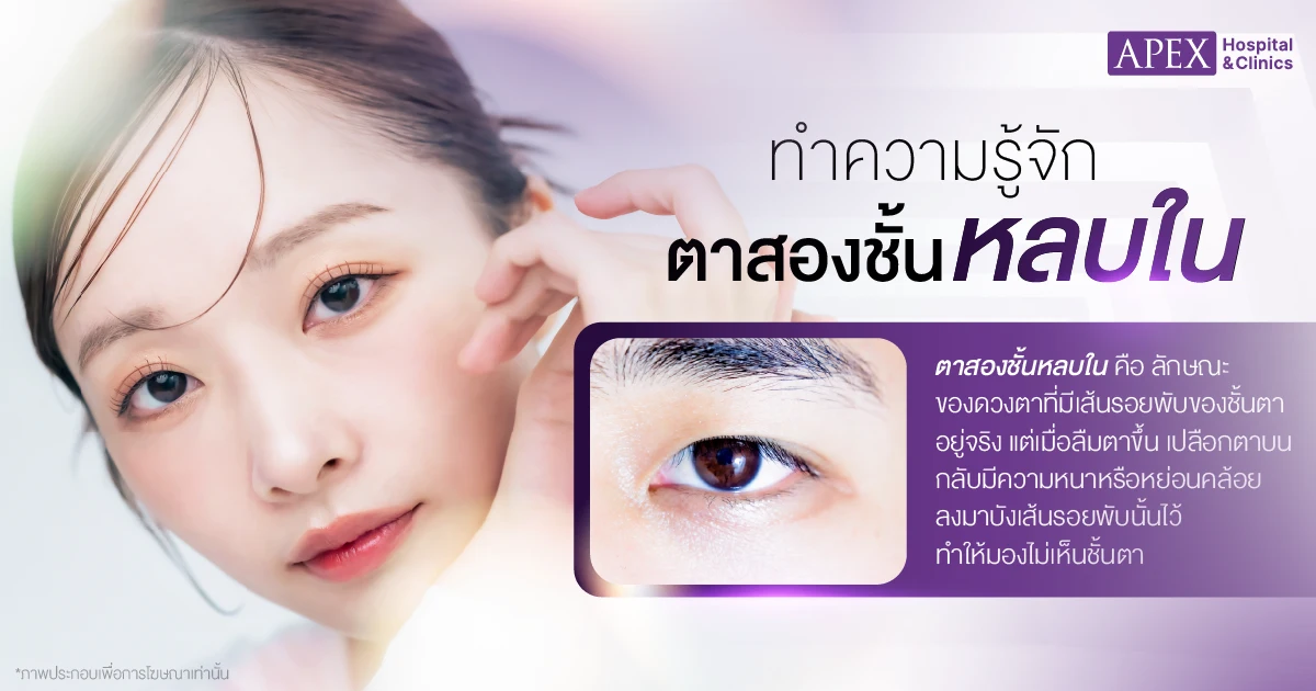 ตาสองชั้นหลบใน