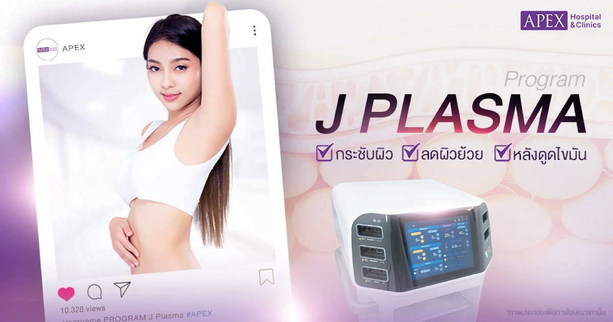 J Plasma