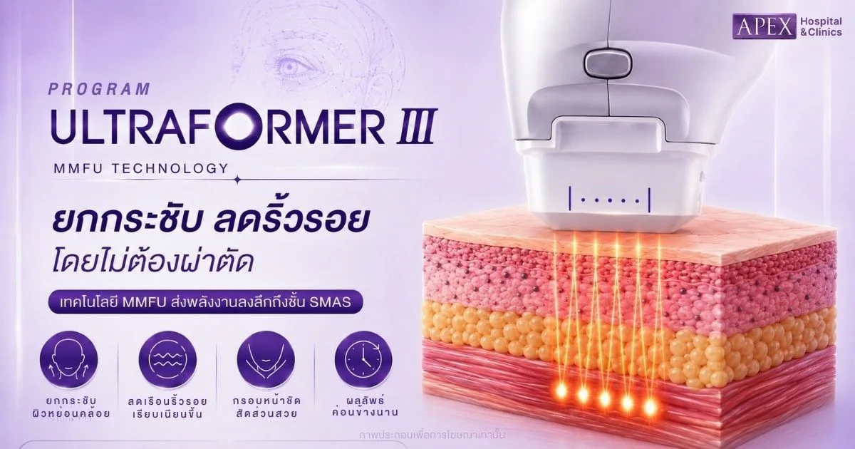Ultraformer III แก้หนังตาตก