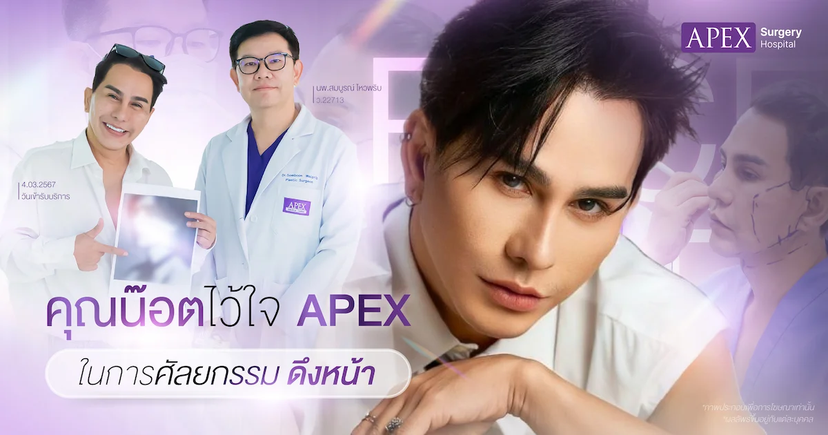 รีวิวดึงหน้า น็อต maxim