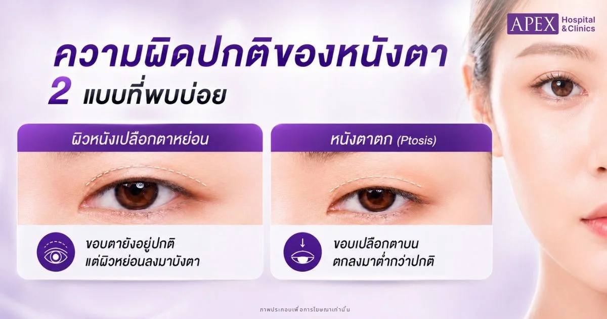 ความผิดปกติของหนังตามีแบบไหนบ้าง