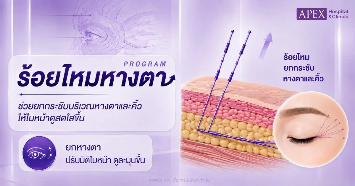 ร้อยไหมหางตา แก้หนังตาตก