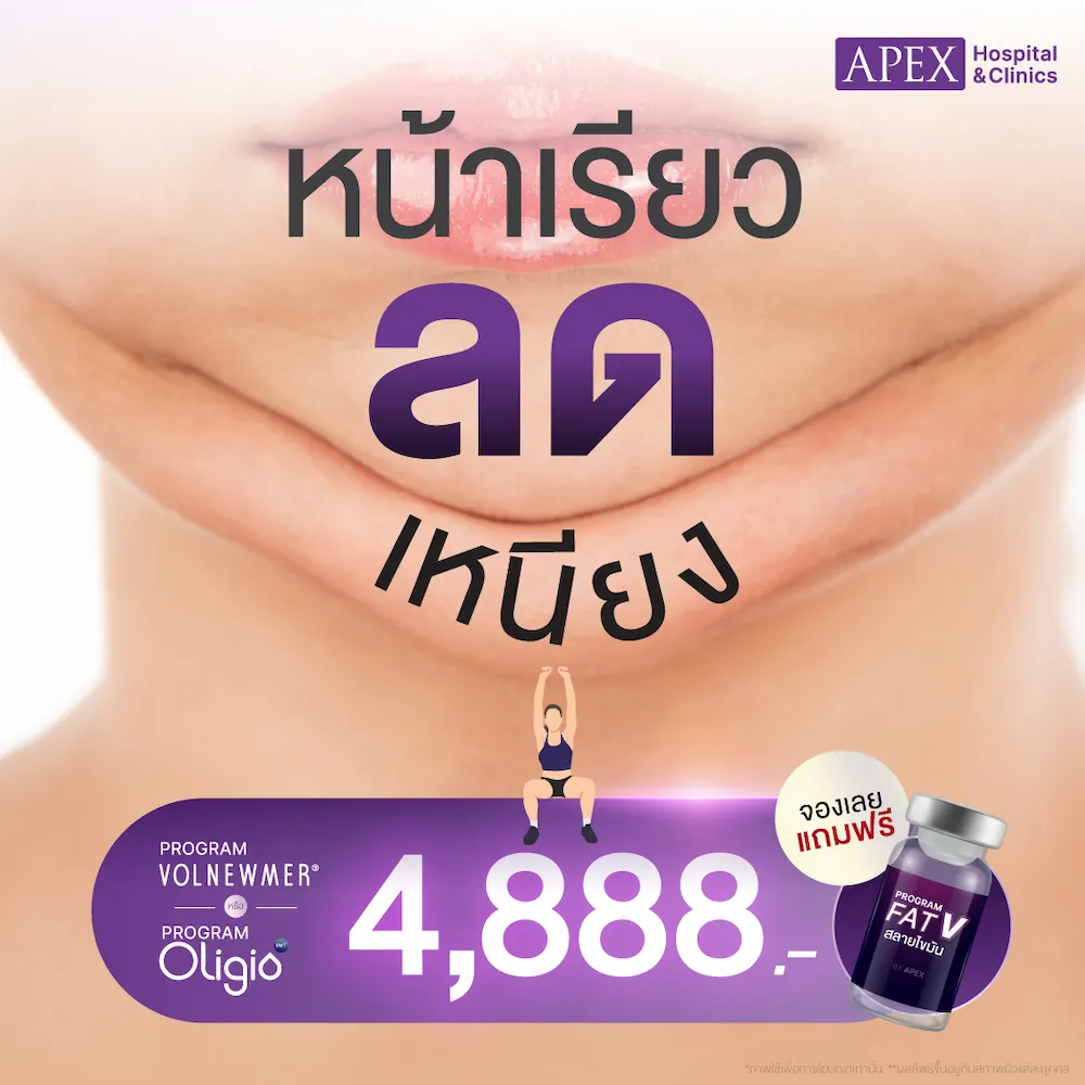 Oligio หรือ Volnewmer ราคา 4,888