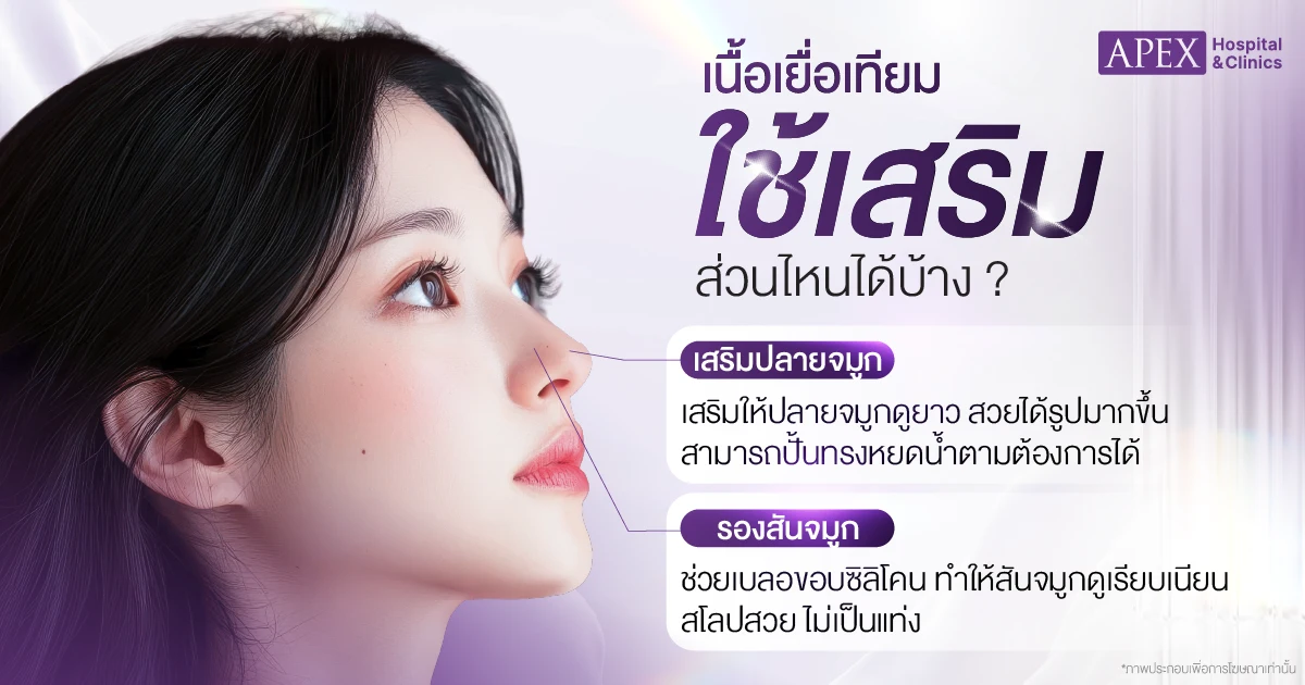 เนื้อเยื่อเทียม 