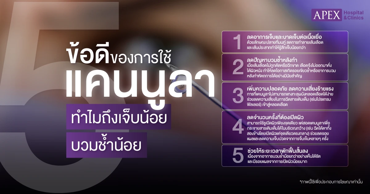 แคนนูลาข้อดี