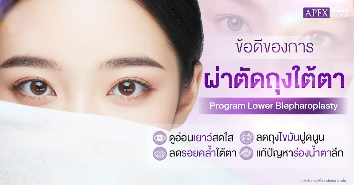 รักษาถุงใต้ตา