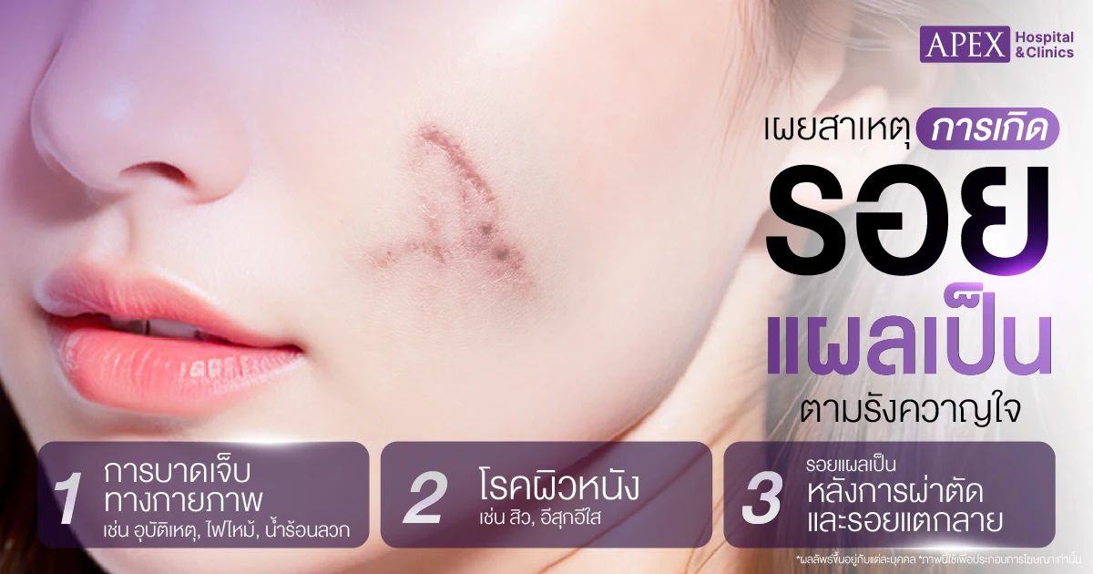 รอยแผลเป็น เกิดจากอะไร