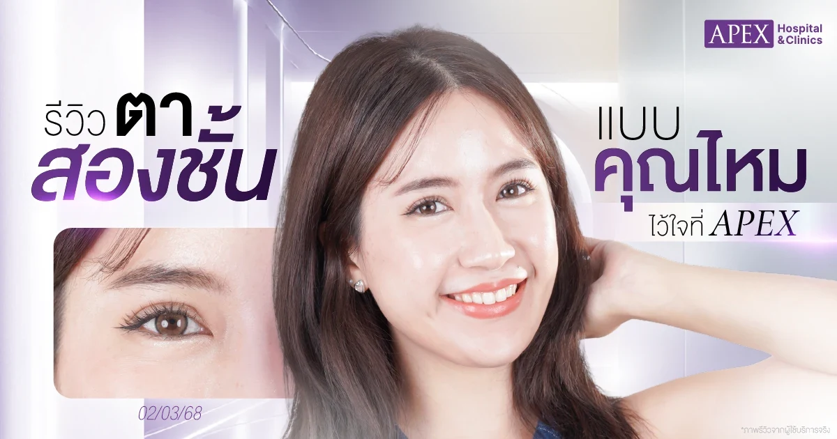 รีวิวตาสองชั้น