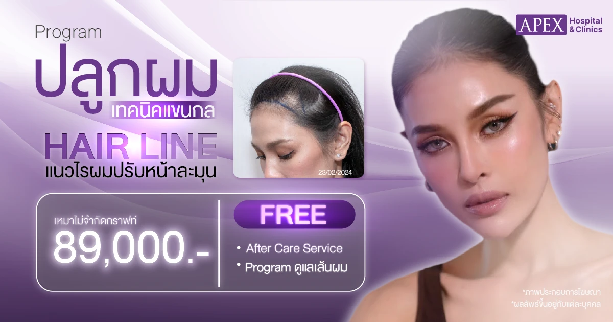 ราคารักษา ผมร่วง