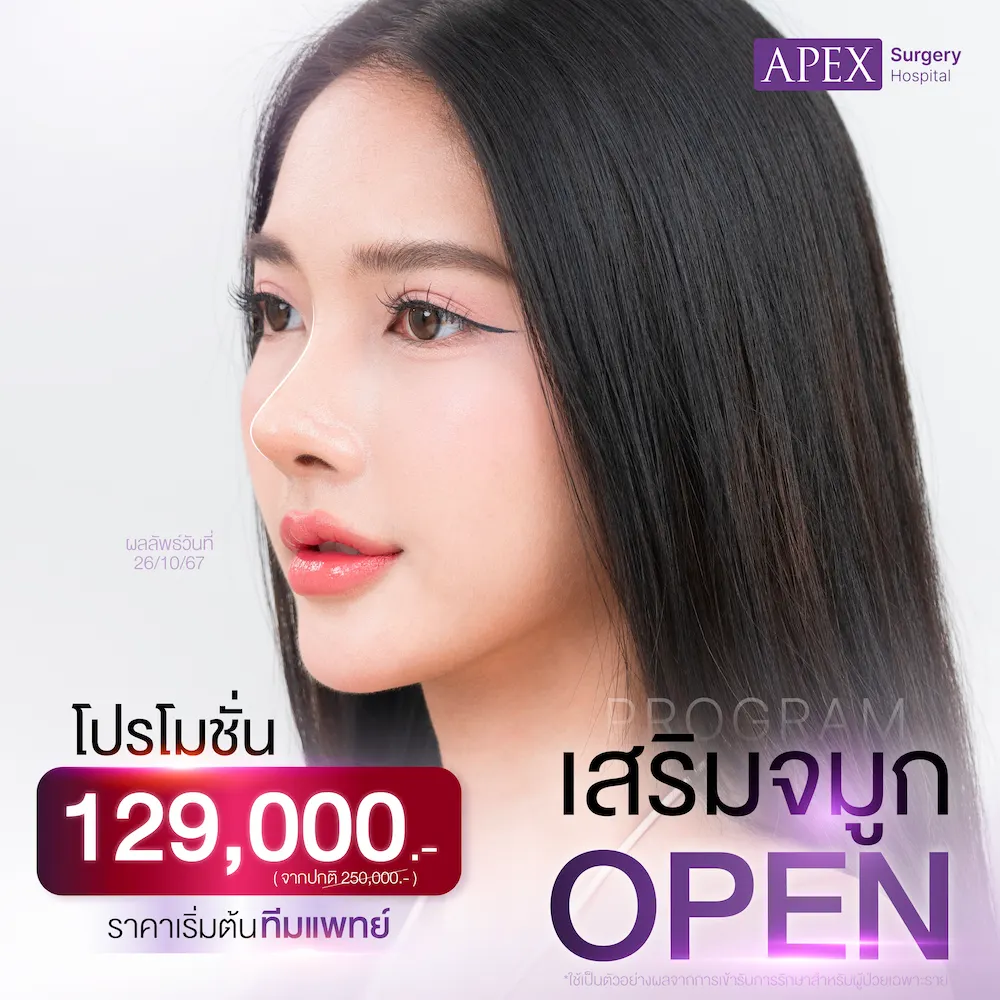 เสริมจมูก ราคา 129,000