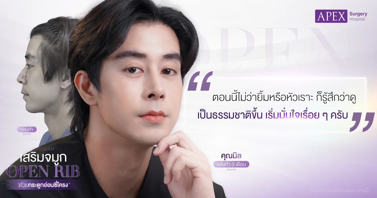 รีวิวเสริมจมูกซี่โครง