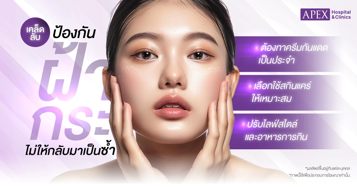 ป้องกันฝ้า กระ