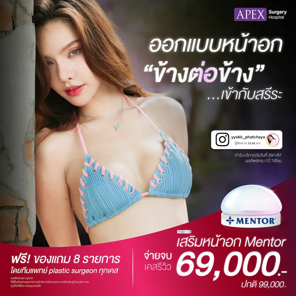 เสริมหน้าอก ราคา 69,000