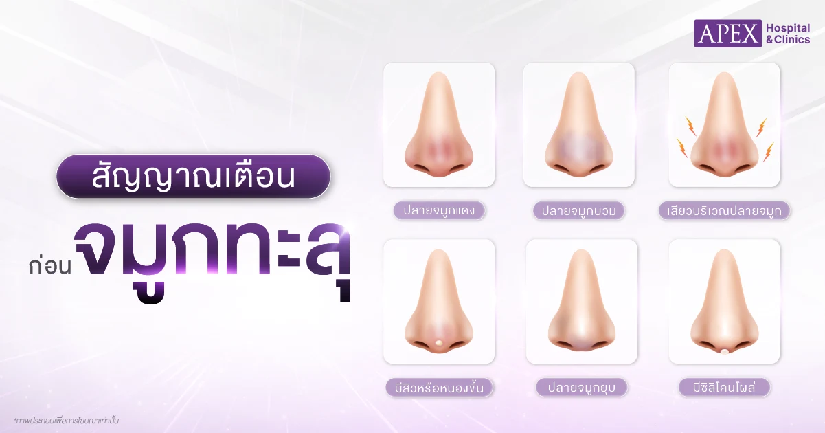 สัญญาณเตือนจมูกทะลุ