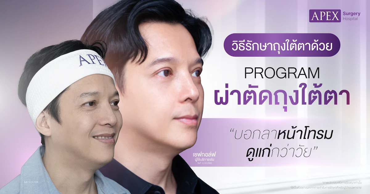 รักษาถุงใต้ตา
