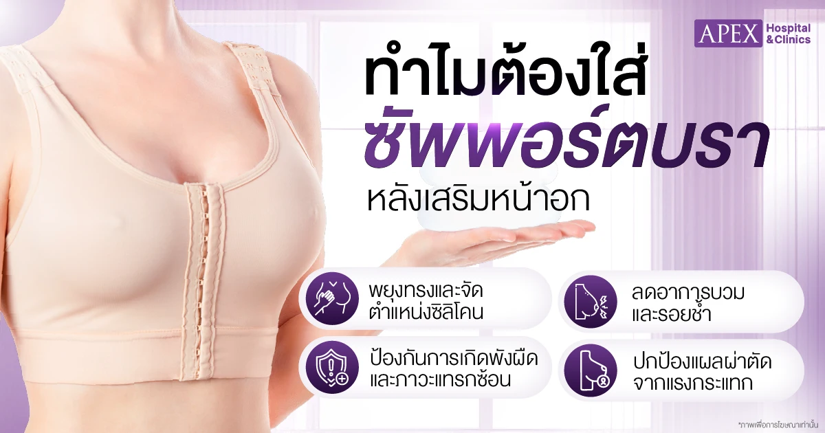 ซัพพอร์ตบรา