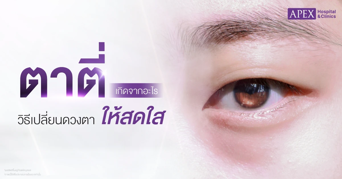ตาตี่