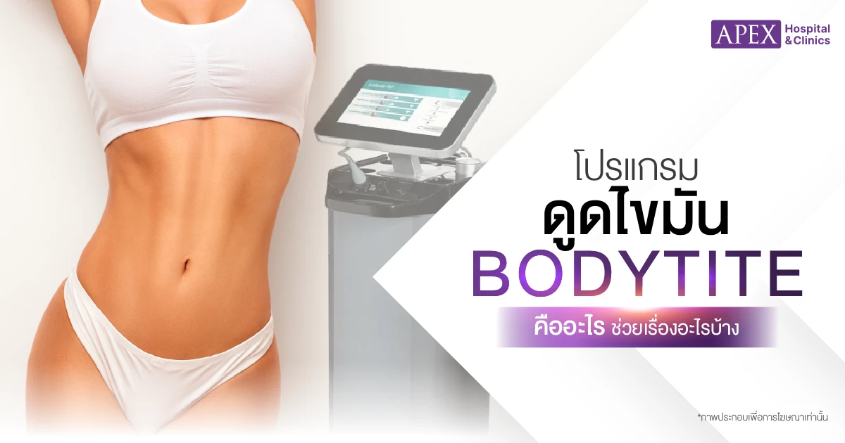 Bodytite