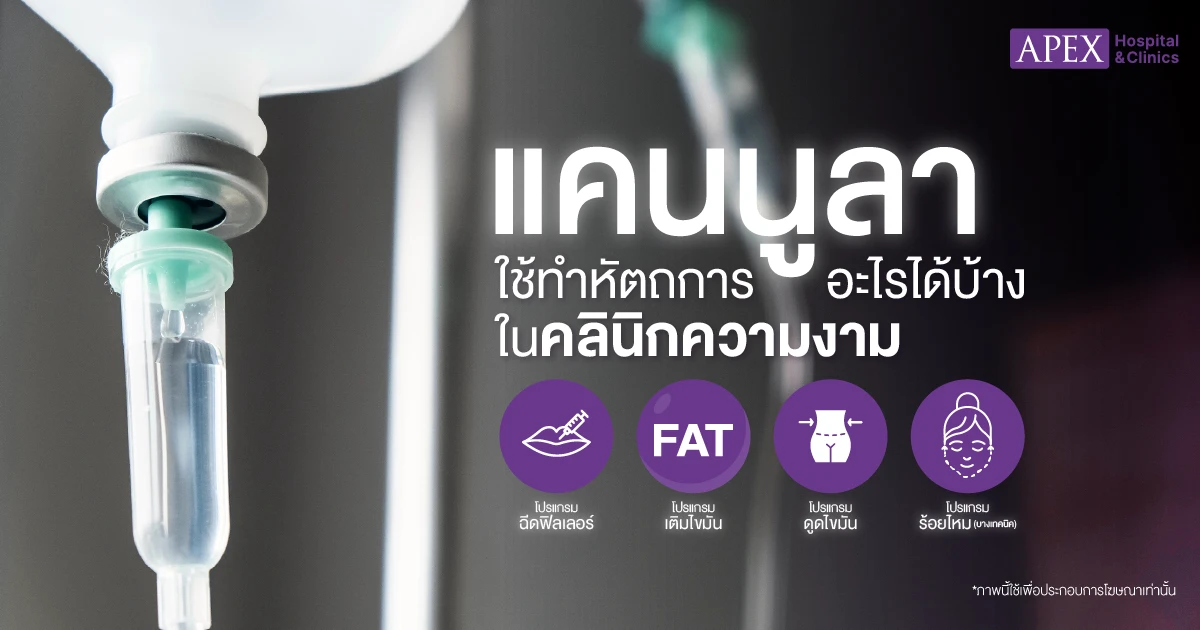 แคนนูลาใช้ทำอะไร