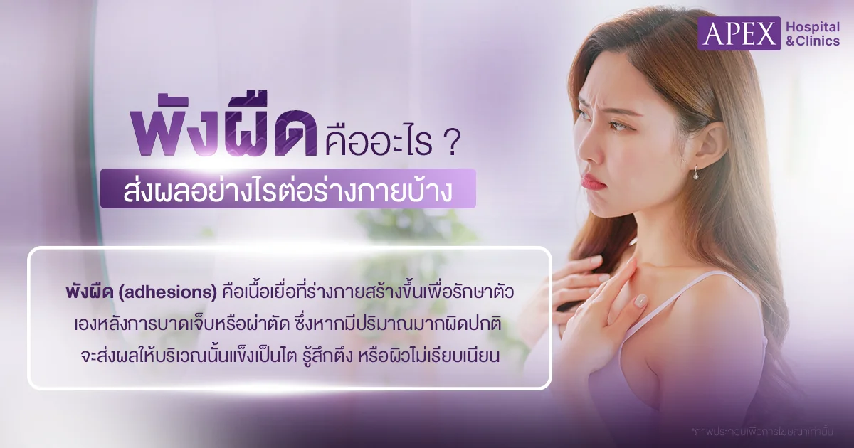 พังผืด คืออะไร